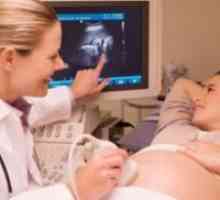 26 Седмица от бременността - фетална размер