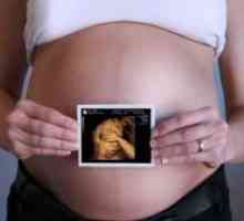3D ултразвук по време на бременност