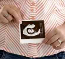 6 Седмици от бременността - феталното развитие