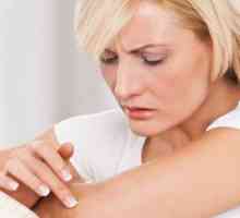 Атопичен дерматит - симптоми и лечение при възрастни