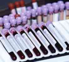 Кръв в онкологията