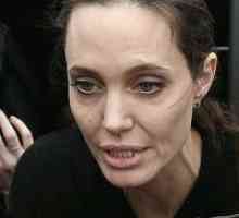 Анджелина Джоли в болница
