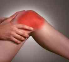 Остеоартрит на коляното - Лечение на народни средства