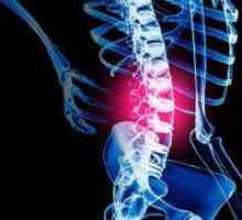 Заболявания на гръбначния стълб
