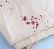Как да се измие кръвта от дрехите си?