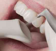 Зъби за почистване на въздушния поток - какво е това?