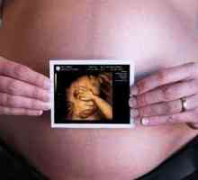 Какво е 3D ултразвук по време на бременност