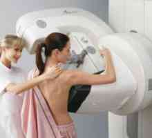 Digital мамография