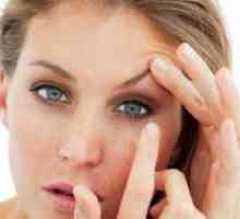 Акнето Eye - симптоми и лечение