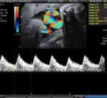 Doplerometrii по време на бременност