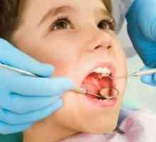 Зъбна флуороза