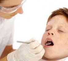 Запечатване на зъбите при деца
