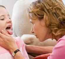 Херпес болки в гърлото при деца - Лечение