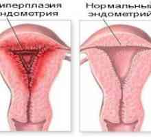 Хиперплазия на ендометриума
