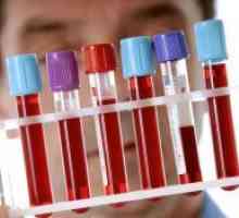Тест ензимен имуноанализ кръв