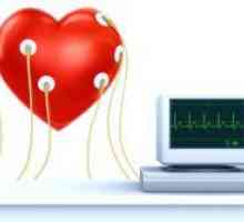 Електрокардиограма на сърцето - препис