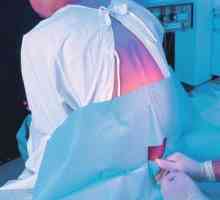 Епидурална анестезия по време на раждане