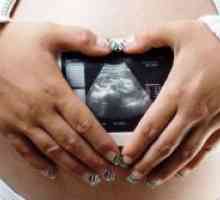 Колко често може да направи ултразвук по време на бременност?