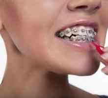 Как да си миете зъбите с брекети?
