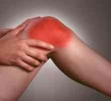Как за лечение на остеоартрит на коляното?