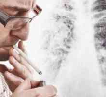 Как за лечение на кашлица пушачи?
