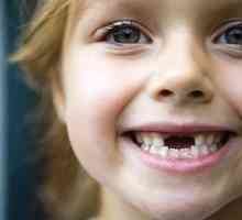 Как да променя зъбите при децата