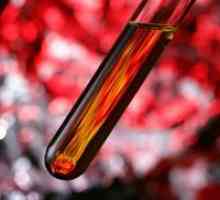 Как да се намали нивото на хемоглобина в кръвта?