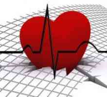 Как да разпознаем инфаркт?