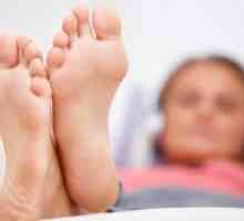 Как да се лекува гъбички на краката си?
