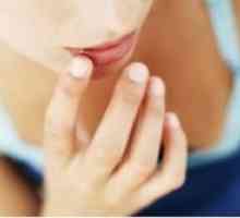 Как да се лекува perleches по устните?