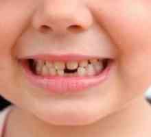 Какви са зъби падат при деца?