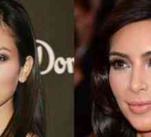 Kim Kardashian преди и след пластмаса