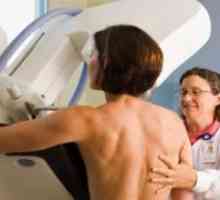 Когато най-добре е да се направи мамография?