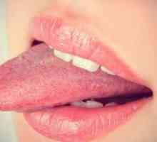 Кафяви петна по езика при възрастни - причини