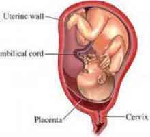 Пределно плацента превия
