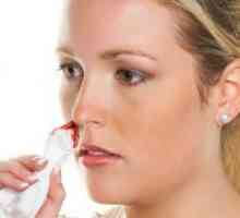 Кървенето от носа по време на бременност