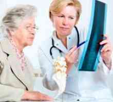Лечение на остеопороза при възрастните жени