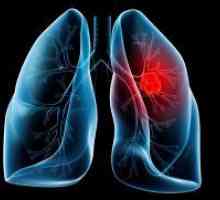 Лечение на рак на белия дроб народни средства