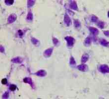 Giardia в черния дроб - симптоми