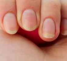 Чупливи нокти - причини