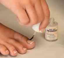Най-добрият лек за гъбички на ноктите на краката си