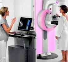 Мамографията - кога да се направи?