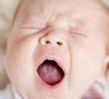 Млечница в устата на бебето - от лечението?