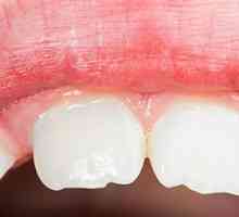 Млечните зъби при децата