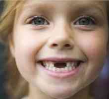 Млечните зъби при децата
