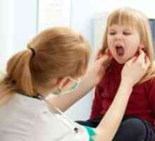 Мононуклеоза при деца - Лечение