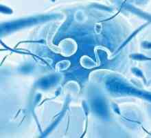 Морфологията на сперматозоидите