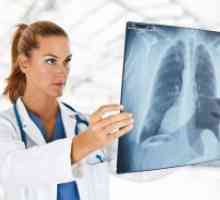 Възможно ли е да се направи рентгенова снимка по време на бременност?