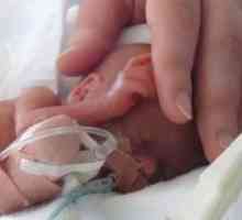 Недоносените бебета - развитие