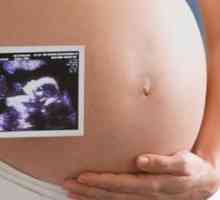 Ниско на плацентата по време на бременност - 21 седмици